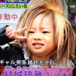 ちいめろ顔変わりすぎ 整形前と過去の顔画像で検証してみた結果は Happynewsblog